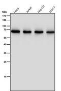 All lanes use the Antibody at 1:5K dilution for 1 hour at room temperature.