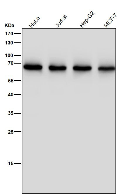 All lanes use the Antibody at 1:5K dilution for 1 hour at room temperature.