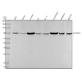 Anti-SLC25A12 Rabbit Monoclonal Antibody