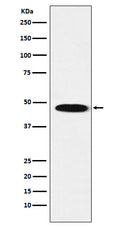 Western blot analysis of GABA A Receptor beta 1 expression in Human cerebellum lysate.