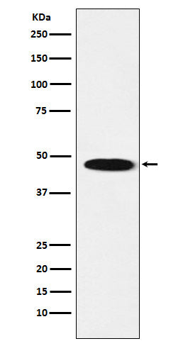 Western blot analysis of GABA A Receptor beta 1 expression in Human cerebellum lysate.