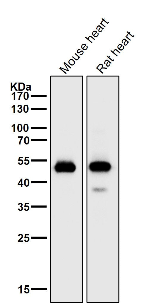 All lanes use the Antibody at 1:2K dilution for 1 hour at room temperature.
