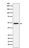Western blot analysis of NR2E1 / Tailless expression in SH-SY5Y cell lysate.