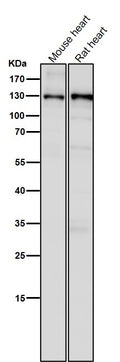 All lanes use the Antibody at 1:5K dilution for 1 hour at room temperature.