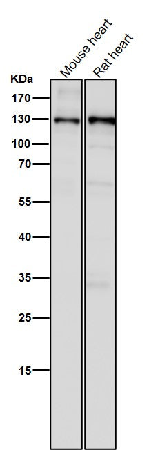 All lanes use the Antibody at 1:5K dilution for 1 hour at room temperature.