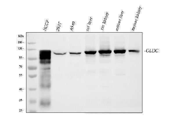 Anti-Glycine decarboxylase/GLDC Antibody Picoband® (monoclonal, 3D3D3)