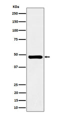 Western blot analysis of SNX5 expression in Jurkat cell lysate.