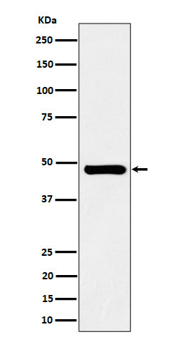 Western blot analysis of SNX5 expression in Jurkat cell lysate.