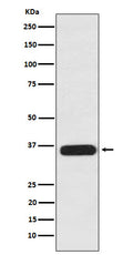 Western blot analysis of PDLIM1 expression in 293T cell lysate.
