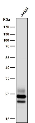 All lanes use the Antibody at 1:5K dilution for 1 hour at room temperature.