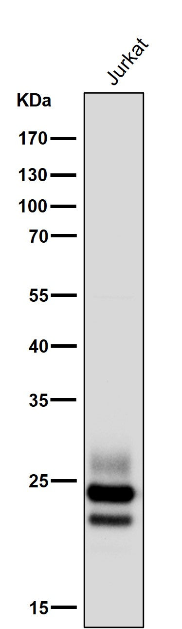 All lanes use the Antibody at 1:5K dilution for 1 hour at room temperature.