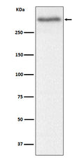 Western blot analysis of Versican expression in Mouse heart cell lysate.