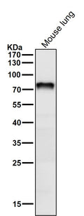 All lanes use the Antibody at 1:1K dilution for 1 hour at room temperature.