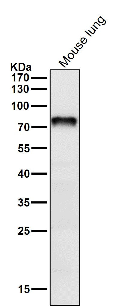 All lanes use the Antibody at 1:1K dilution for 1 hour at room temperature.