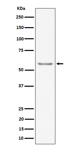 Western blot analysis of ICAM2 / CD102 expression in mouse heart cell lysate.