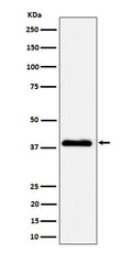 Western blot analysis of NSDHL expression in A431 cell lysate.