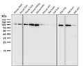 All lanes use the Antibody at 1:3K dilution for 1 hour at room temperature.
