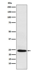 Western blot analysis of BAG2 expression in HepG2 cell lysate.