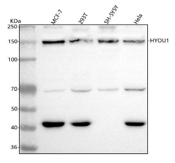 Anti-ORP150 Rabbit Monoclonal Antibody