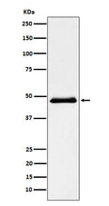 Western blot analysis of Pancreatic Lipase (PNLIP) expression in Human pancreas lysate.