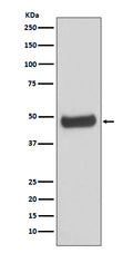 Western blot analysis of PKA 2 beta expression in human fetal brain lysate.