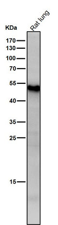 All lanes use the Antibody at 1:1K dilution for 1 hour at room temperature.