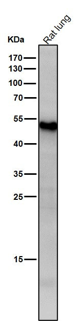 All lanes use the Antibody at 1:1K dilution for 1 hour at room temperature.