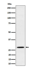 Western blot analysis of PSMB10 expression in Raji cell lysate.