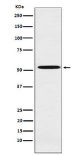 Western blot analysis of ALDH1A2 expression in Molt4 cell lysate.