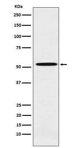 Western blot analysis of ALDH1A2 expression in Molt4 cell lysate.