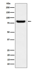 Western blot analysis of GLU2B expression in A431 cell lysate.