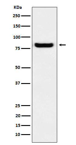 Western blot analysis of GLU2B expression in A431 cell lysate.
