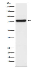 Western blot analysis of KLKB1 expression in human plasma lysate.