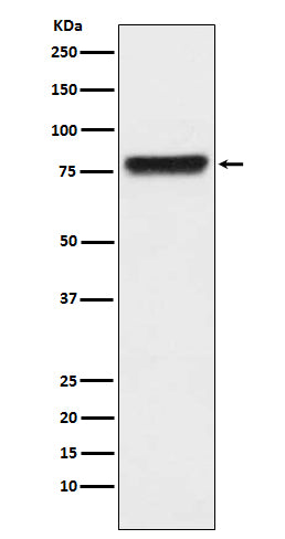 Western blot analysis of KLKB1 expression in human plasma lysate.