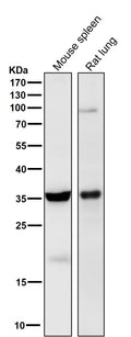 All lanes use the Antibody at 1:1K dilution for 1 hour at room temperature.