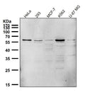 All lanes use the Antibody at 1:1K dilution for 1 hour at room temperature.