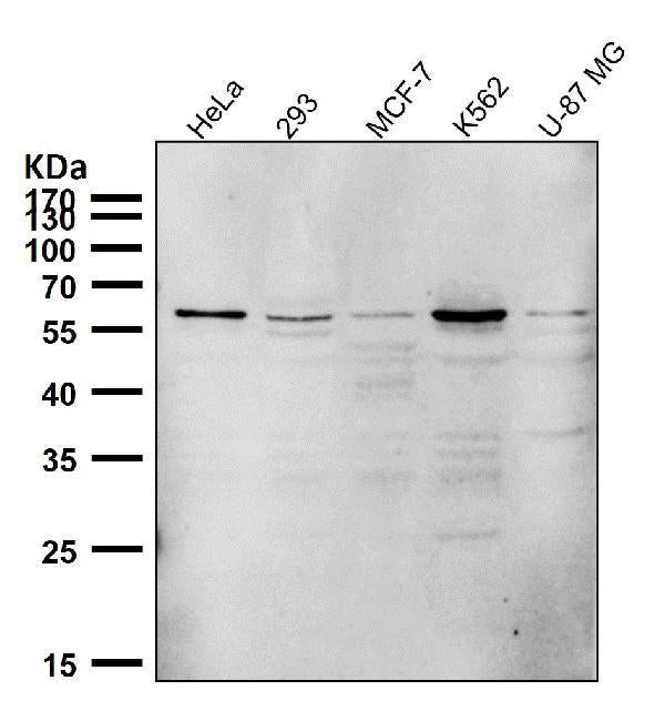All lanes use the Antibody at 1:1K dilution for 1 hour at room temperature.