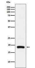 Western blot analysis of ARF5 expression in Hela cell lysate.
