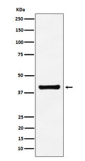 Western blot analysis of Aldolase expression in A549 cell lysate.