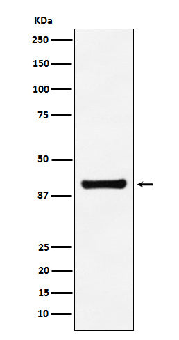 Western blot analysis of Aldolase expression in A549 cell lysate.