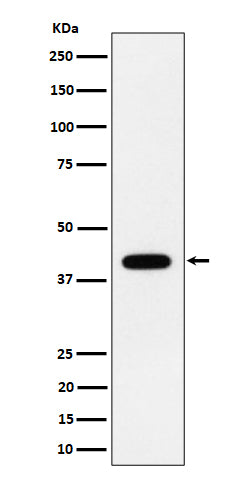 Western blot analysis of ACADS / SCAD expression in HeLa cell lysate.