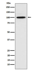 Western blot analysis of CTNNA3 expression in 293 cell lysate.