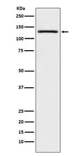 Western blot analysis of USP28 expression in A431 cell lysate.