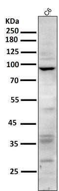 All lanes use the Antibody at 1:1K dilution for 1 hour at room temperature.