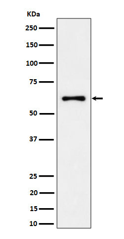 Western blot analysis of EYA2 expression in 293T cell lysate.
