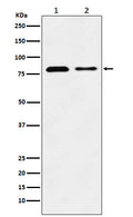 Western blot analysis of LIMPII expression in (1) HeLa cell lysate; (2) Mouse liver lysate.