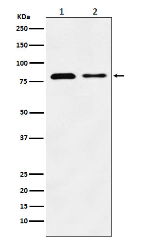 Western blot analysis of LIMPII expression in (1) HeLa cell lysate; (2) Mouse liver lysate.