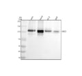 Anti-Desmocollin-3 Rabbit Monoclonal Antibody