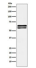 Western blot analysis of NAP1L1 expression in Jurkat cell lysate.