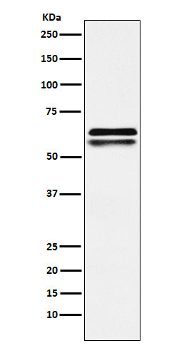 Western blot analysis of NAP1L1 expression in Jurkat cell lysate.